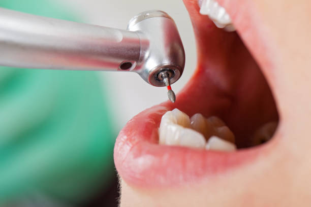 Best 24-Hour Emergency Dental Care in Crockett, TX